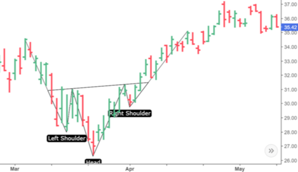 Pfizer stocks. 1D TF. Head and shoulders pattern